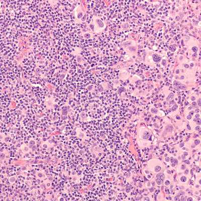 theme pic for article 8496