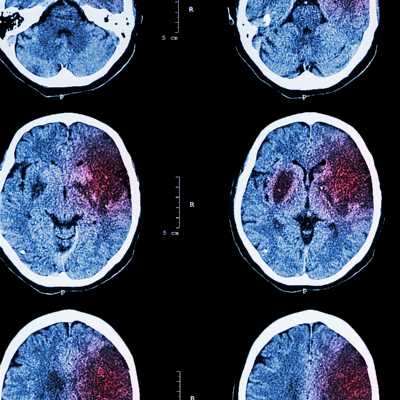 theme pic for article 9477